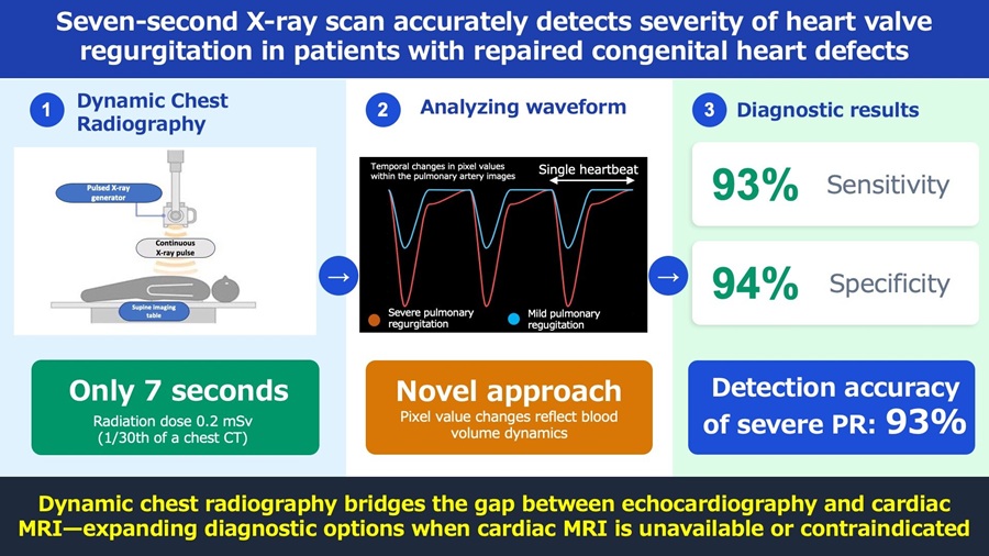 Image: Kyushu University researchers use Dynamic Chest Radiography (DCR) to evaluate the severity of Pulmonary Regurgitation (PR), a common complication after treatment of the congenital heart disease Tetralogy of Fallot. The analysis only requires the patient to hold their breath for seven seconds for a sequence of images of their heart to be taken. The images are then analyzed and extracted into a waveform that can show the severity of PR. The new technique\'s detection accuracy of severe PR is 93%, with a sensitivity of 93% and a specificity of 94%. (Photo courtesty of Kyushu University/Yuzo Yamasaki)