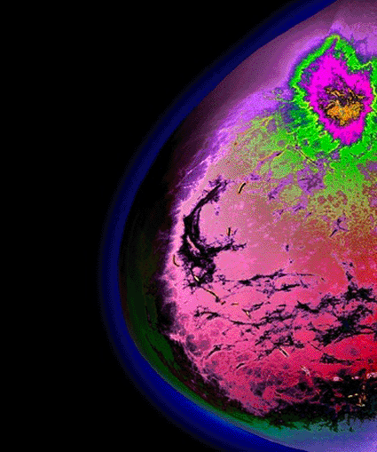 Image: Colored profile x-ray of the left breast of a 65-year-old woman with breast cancer (Photo courtesy of Zephyr / SPL)