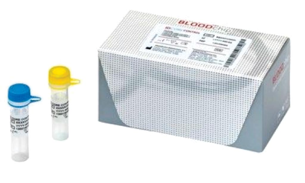 Набор для генотипирования группы крови ID Core XT (фото любезно предоставлено Progenika Biopharma). Набор для генотипирования группы крови ID Core XT (фото любезно предоставлено Progenika Biopharma).